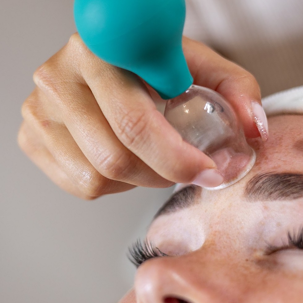 Close-up van een cupping glas met een turquoise ballon op het voorhoofd van een klant